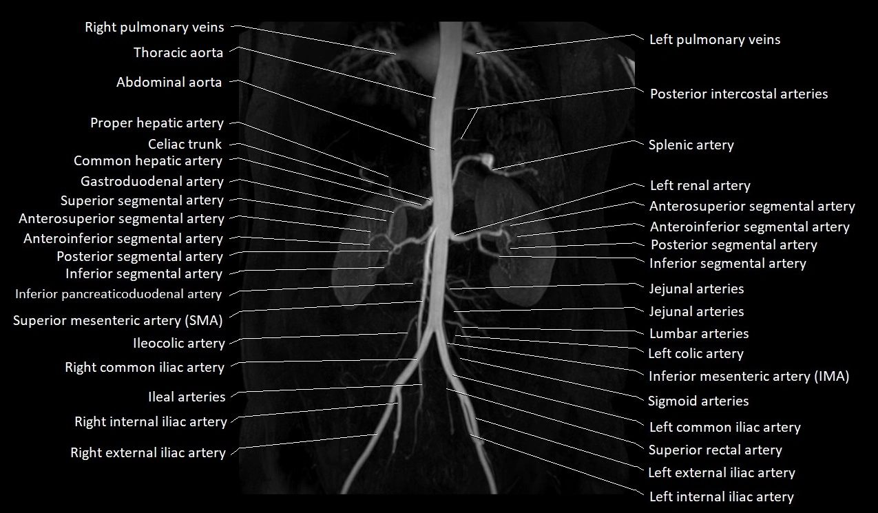 MRA abdomen (renal and mesenteric) angiography MIP 3D anatomy image 2.webp